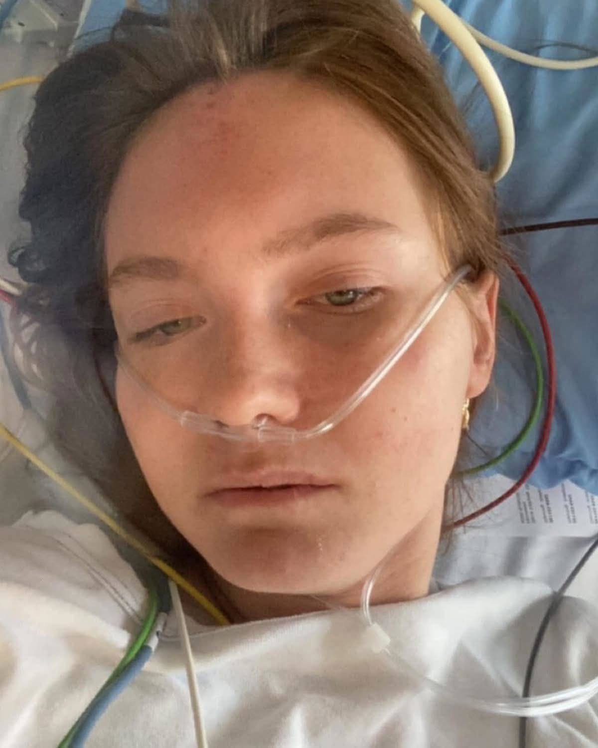Ung kvinde ligger i hospitalsseng med iltslanger i næsen